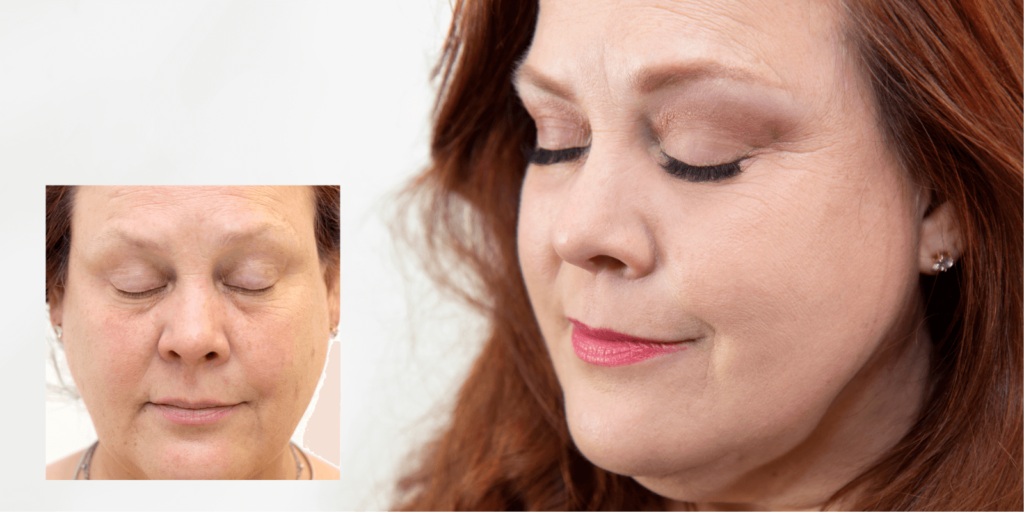 Before and after of eyelash enhancement